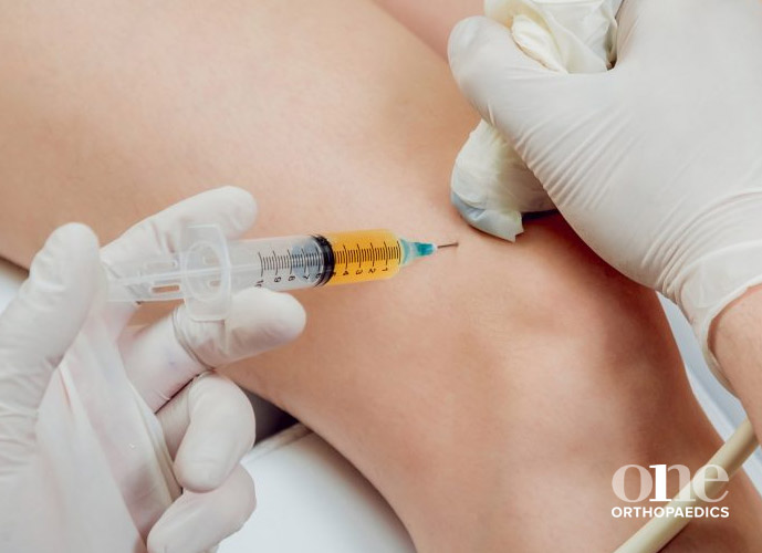 Steroid Injection