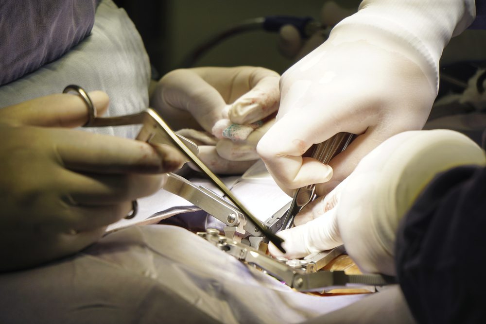 Closeup of doctors performing spinal surgery