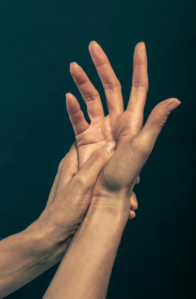 Hand with arthritis