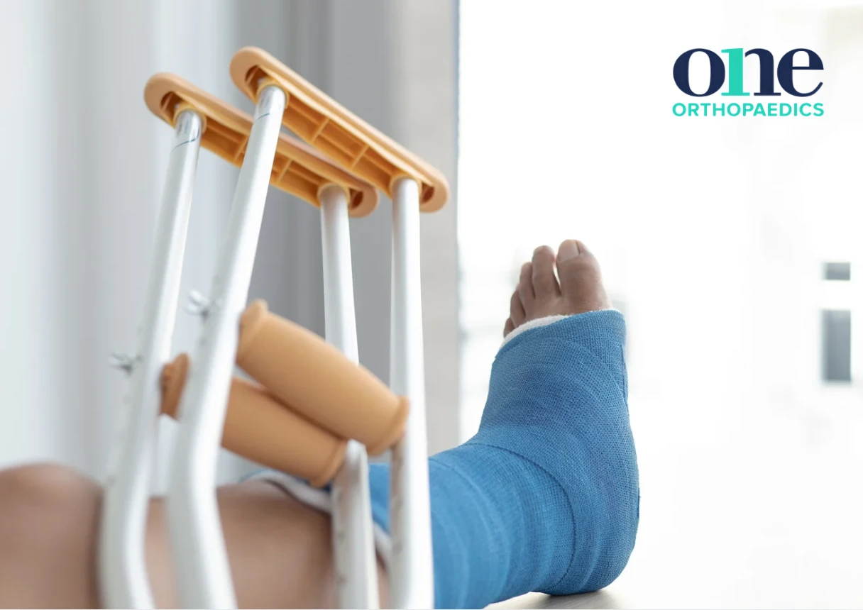 You are currently viewing How to Recognise the Signs of a Broken Bone and What to Do Next